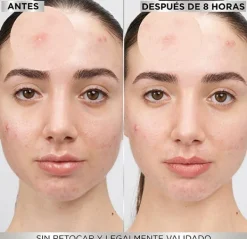 GARNIER Hidratantes Faciales<8 Hours Pimple Patch