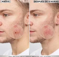 GARNIER Hidratantes Faciales<8 Hours Pimple Patch