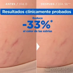 MIXA Anticelulíticos<Aceite Anti-Estrías