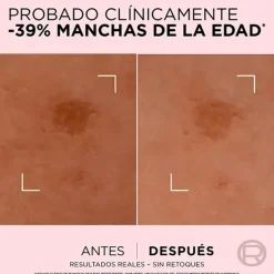 L'OREAL PARIS Serums|Hidratantes Faciales<Age Perfect