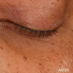 CLINIQUE Contorno Ojos|Hidratantes Faciales<All About Eyes