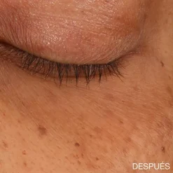 CLINIQUE Contorno Ojos|Hidratantes Faciales<All About Eyes