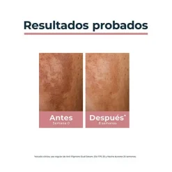 EUCERIN Hidratantes Faciales<Anti-Pigment Dual Serum