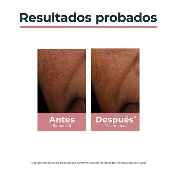 EUCERIN Hidratantes Faciales<Anti-Pigment Spot Corrector