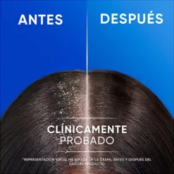 H&S Hidratantes Faciales|Anticaspa<Apple Fresh