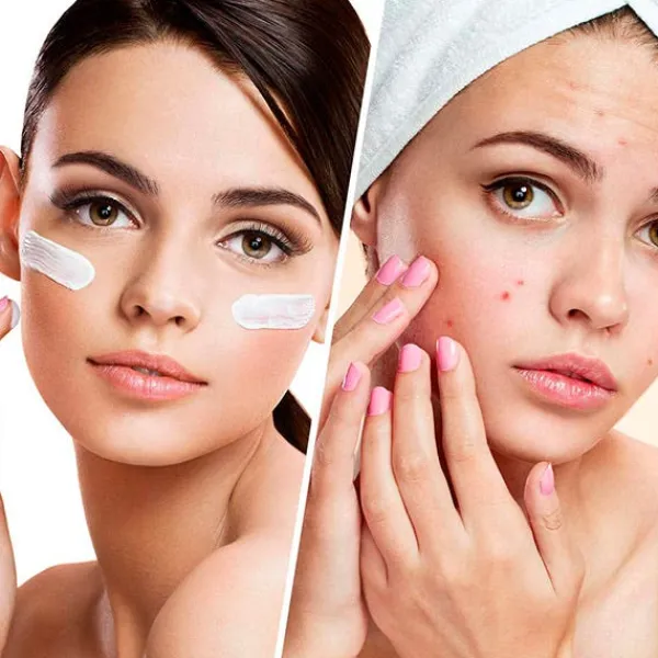 BIOVENE Hidratación|Cruelty Free<Blemish Control