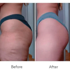 COCUNAT Anticelulíticos|Hidratantes Faciales<Body Power