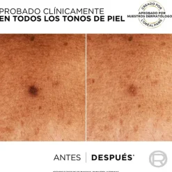 L'OREAL PARIS Serums|Serum Antimanchas<Bright Reveal