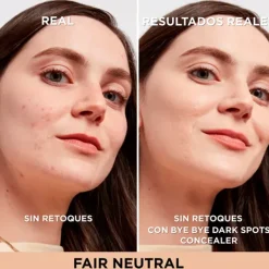 Outlet Bye Bye Dark Spots Concealer + Serum Correctores De Maquillaje