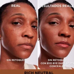 Outlet Bye Bye Dark Spots Concealer + Serum Correctores De Maquillaje