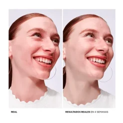 New Bye Bye Redness Serums