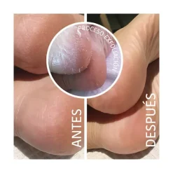 Online Calcetines Mascarilla Exfoliante Mascarillas