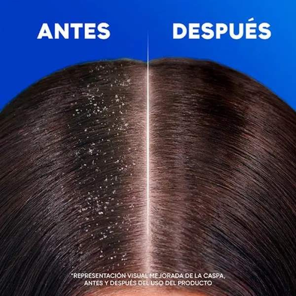 H&S Anticaspa<Citrus Fresh