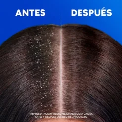 H&S Anticaspa<Classic