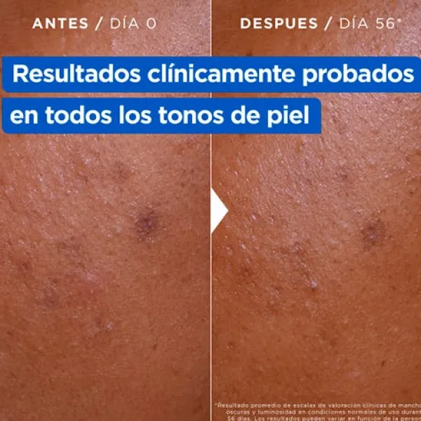 MIXA Hidratantes|Cremas<Crema Hidratante Anti-Manchas