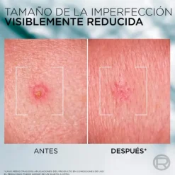 L'OREAL MEN EXPERT Hidratantes Faciales|Cosmética Corporal<Derma Control Sos Paste