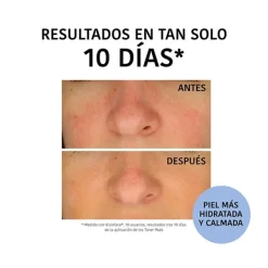 Online Discos Hidratantes De Arándanos Limpieza