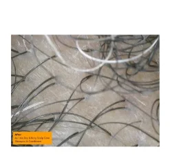 AS I AM Hidratantes Faciales|Champús<Dry & Itchy