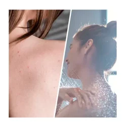 BIOVENE Limpieza<Exfoliante Salicylic Blemish