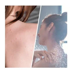 Discount Exfoliante Salicylic Blemish Limpieza