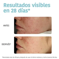 IROHA NATURE Exfoliantes|Limpieza<Exfoliating Anti-Blemish