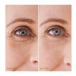 FOREO Contorno Ojos|Mascarillas<Iris Under-Eye-Patches