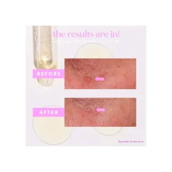 Best Makes You Glow F4 Serums