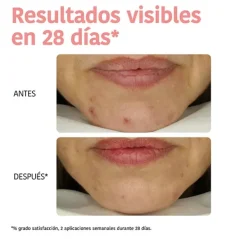 Outlet Mascarilla Peeling Piel Perfecta Mascarillas