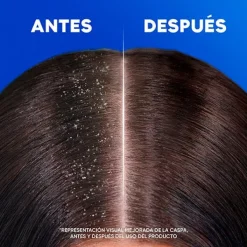 H&S Anticaspa<Menthol