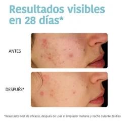 IROHA NATURE Limpieza|Hidratantes Faciales<Purifying Anti-Blemish