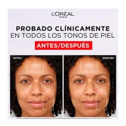 L'OREAL PARIS Antiedad|Hidratantes Faciales<Revitalift Filler