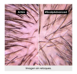 L'OREAL PROFESSIONNEL Champús<Scalp Advanced