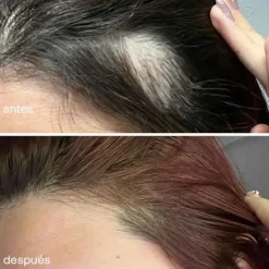 UKLASH Serums<Serum De Crecimiento Del Cabello