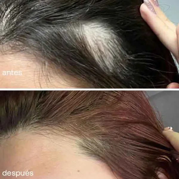 UKLASH Serums<Serum De Crecimiento Del Cabello