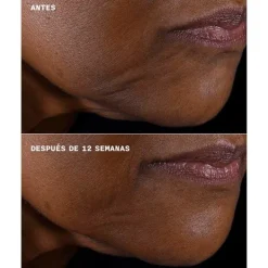 CLINIQUE Antiedad<Smart Clinical Repair Lifting Face + Neck Cream