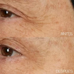 CLINIQUE Hidratantes Faciales<Smart Clinical Repair Overnight Recovery Cream + Mask