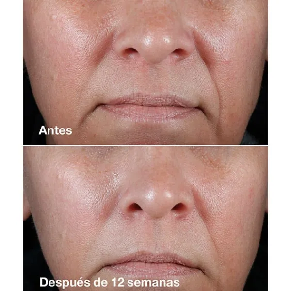 CLINIQUE Antiedad|Hidratantes Faciales<Smart Clinical Repair Rich Cream