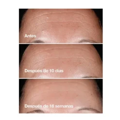 CLINIQUE Serums<Smart Clinical Repair™ Serum