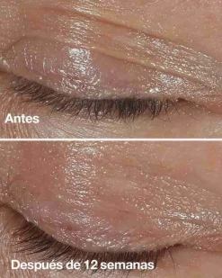 CLINIQUE Contorno Ojos<Smart Clinical Repair Wrinkle Correcting Eye Cream