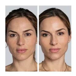 COCUNAT Vitamina C|Rostro<The Real C