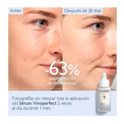 CAUDALIE Serum Antimanchas|Serum<Vinoperfect