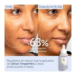 CAUDALIE Serum Antimanchas|Serum<Vinoperfect
