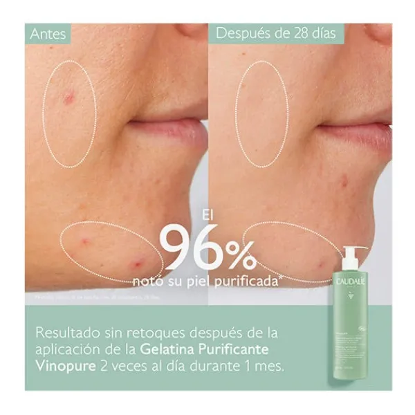 CAUDALIE Limpieza<Vinopure