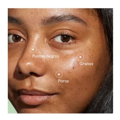 CAUDALIE Hidratantes Faciales|Serum<Vinopure