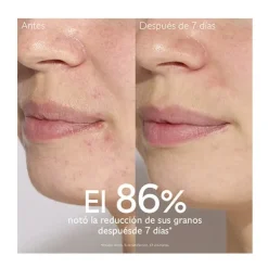 CAUDALIE Hidratantes Faciales|Serum<Vinopure