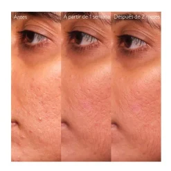 CAUDALIE Hidratantes Faciales|Serum<Vinopure